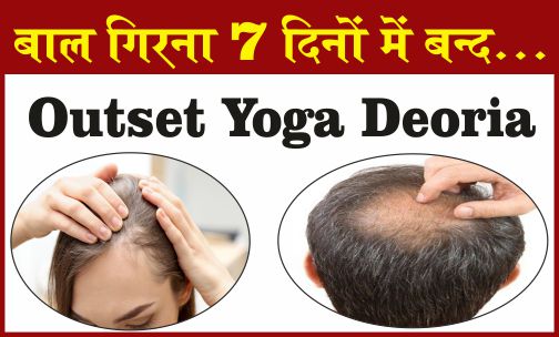 hair loss treatment in deoria